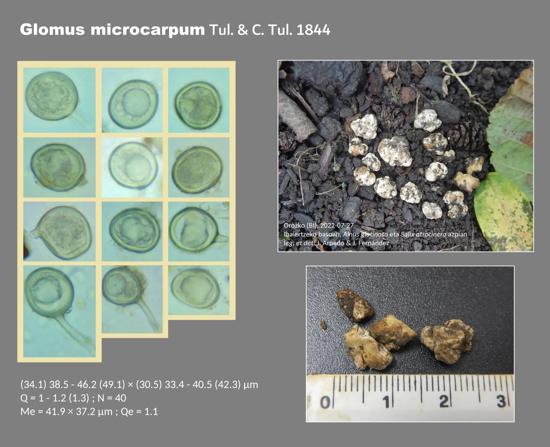Microscopía de Glomus microcarpum